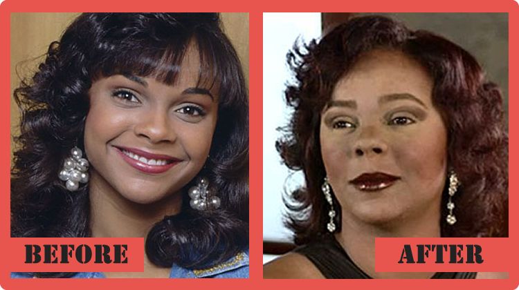 Lark-Voorhies-Plastic-Surgery-Before-And-After.jpg